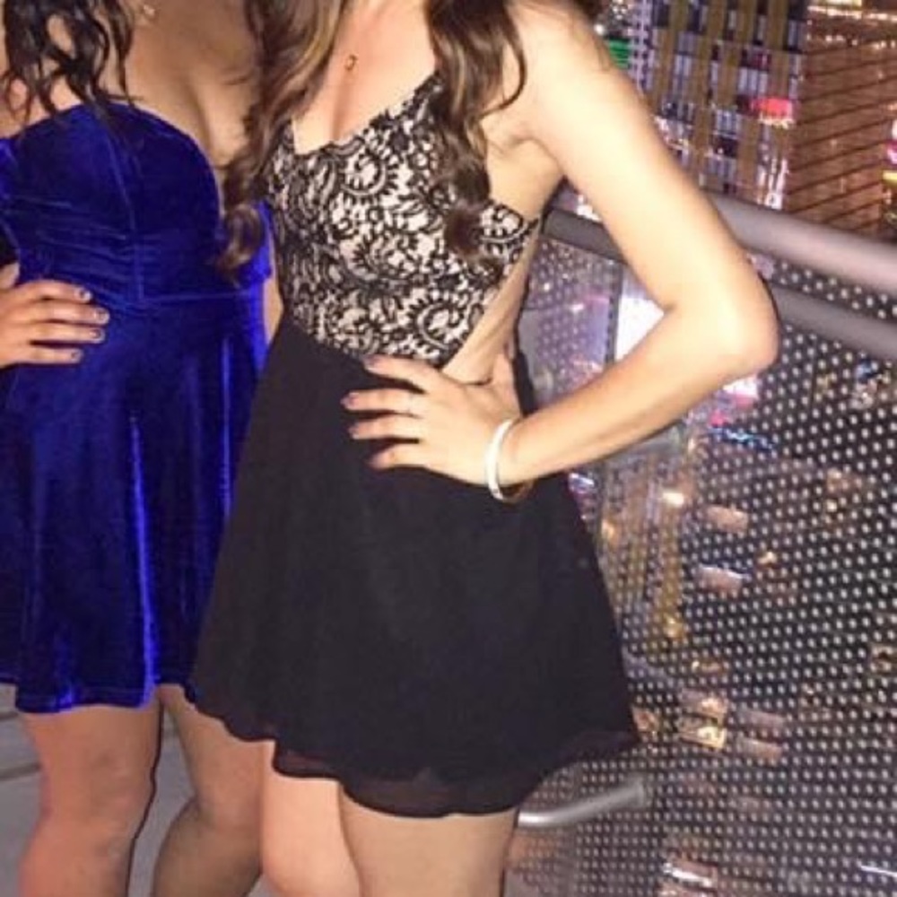 Lace Open Back Romper